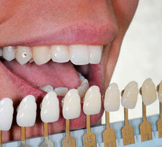 Person måler om tandpasta med whitening virker