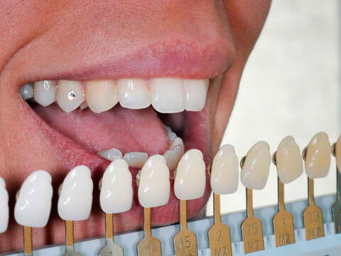 Person måler om tandpasta med whitening virker