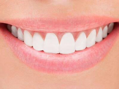 Mund med meget hvide tænder hvor der måske er brugt tandblegning